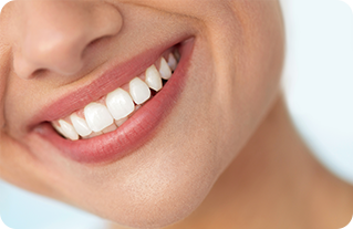 Porcelain veneers illustration